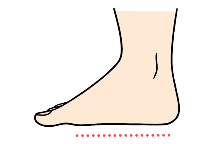 足のうらが平らで、土踏まずがない　